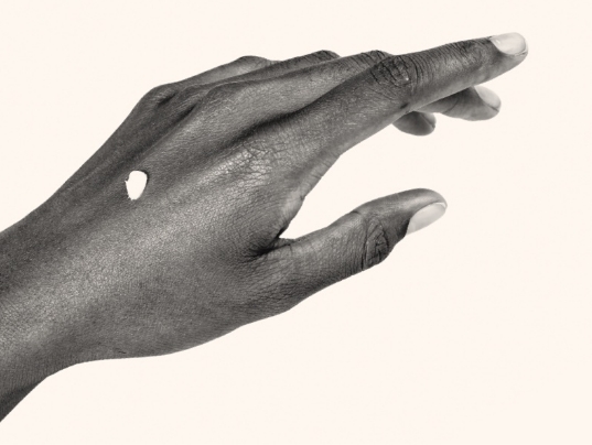 Hand with a small amount of ZORYVE roflumilast cream.